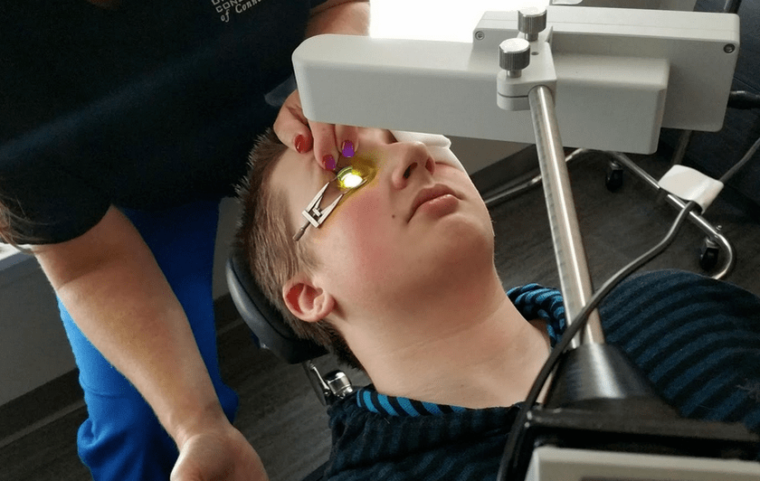 Crosslinking elimineert effectief Keratoconus aan het begin van zijn ontwikkeling